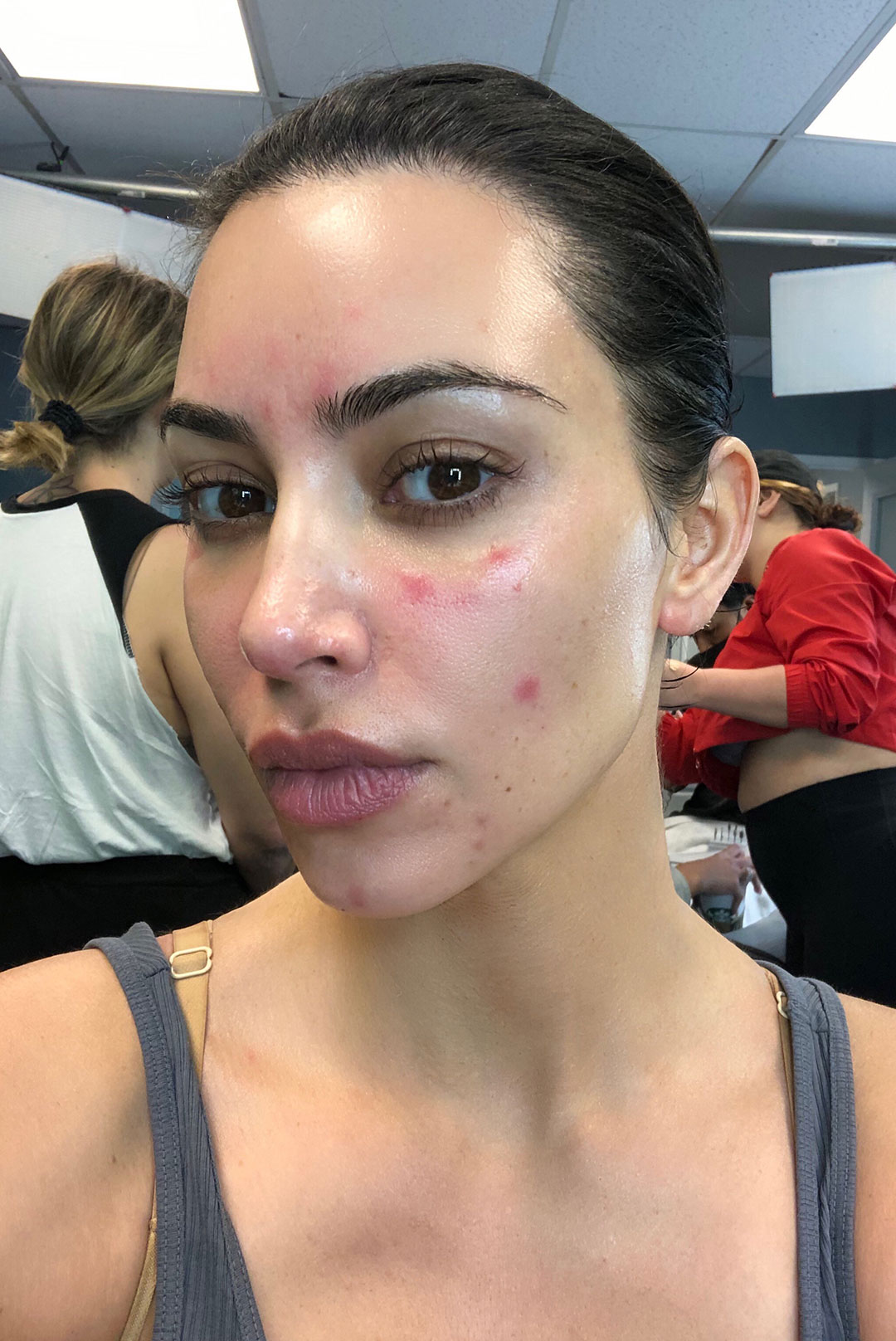 Kim Kardashian Shares Her Journey With Psoriasis Poosh   Promo 13 