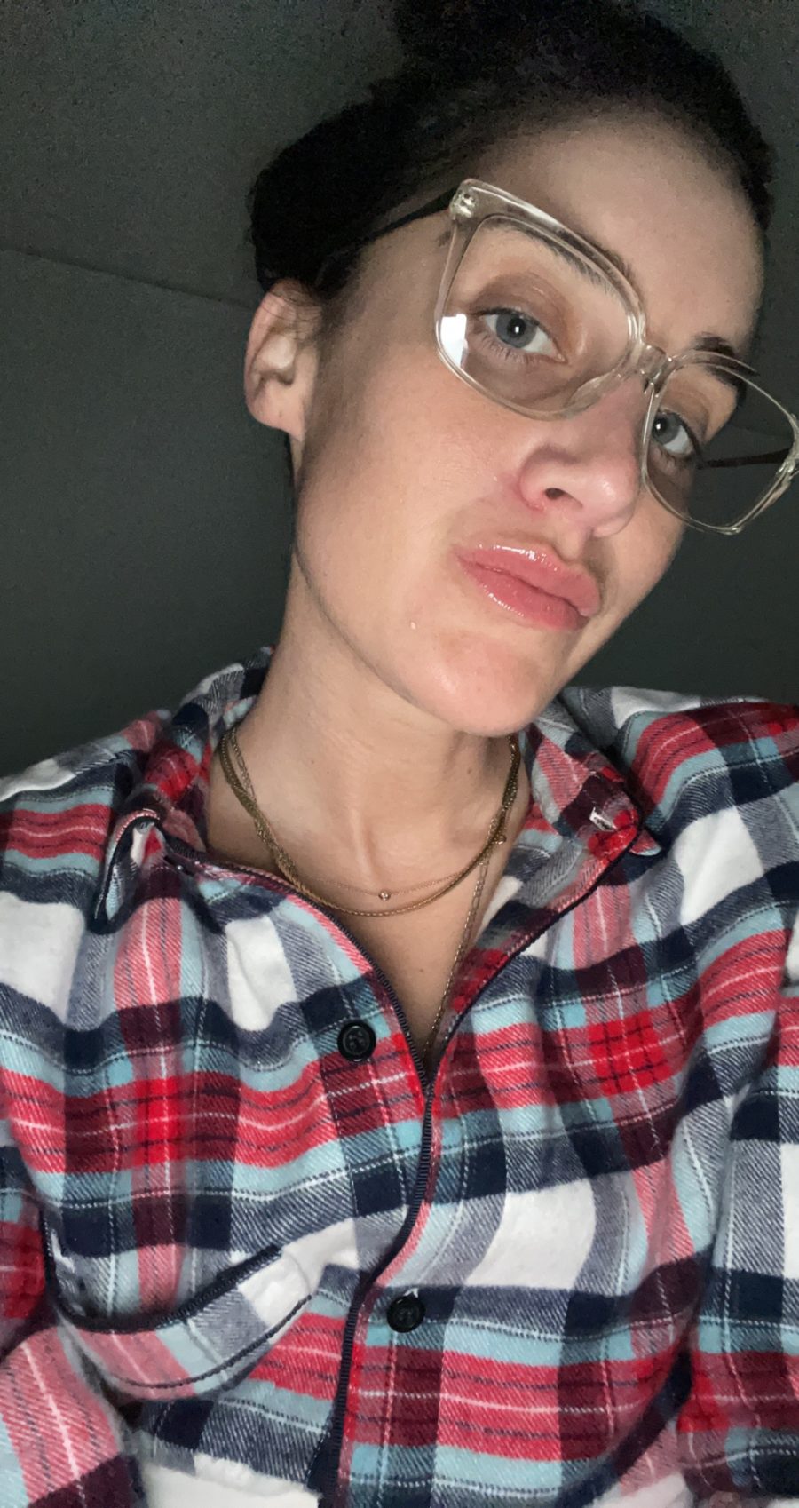 woman in pjs and glasses with Perioral Dermatitis