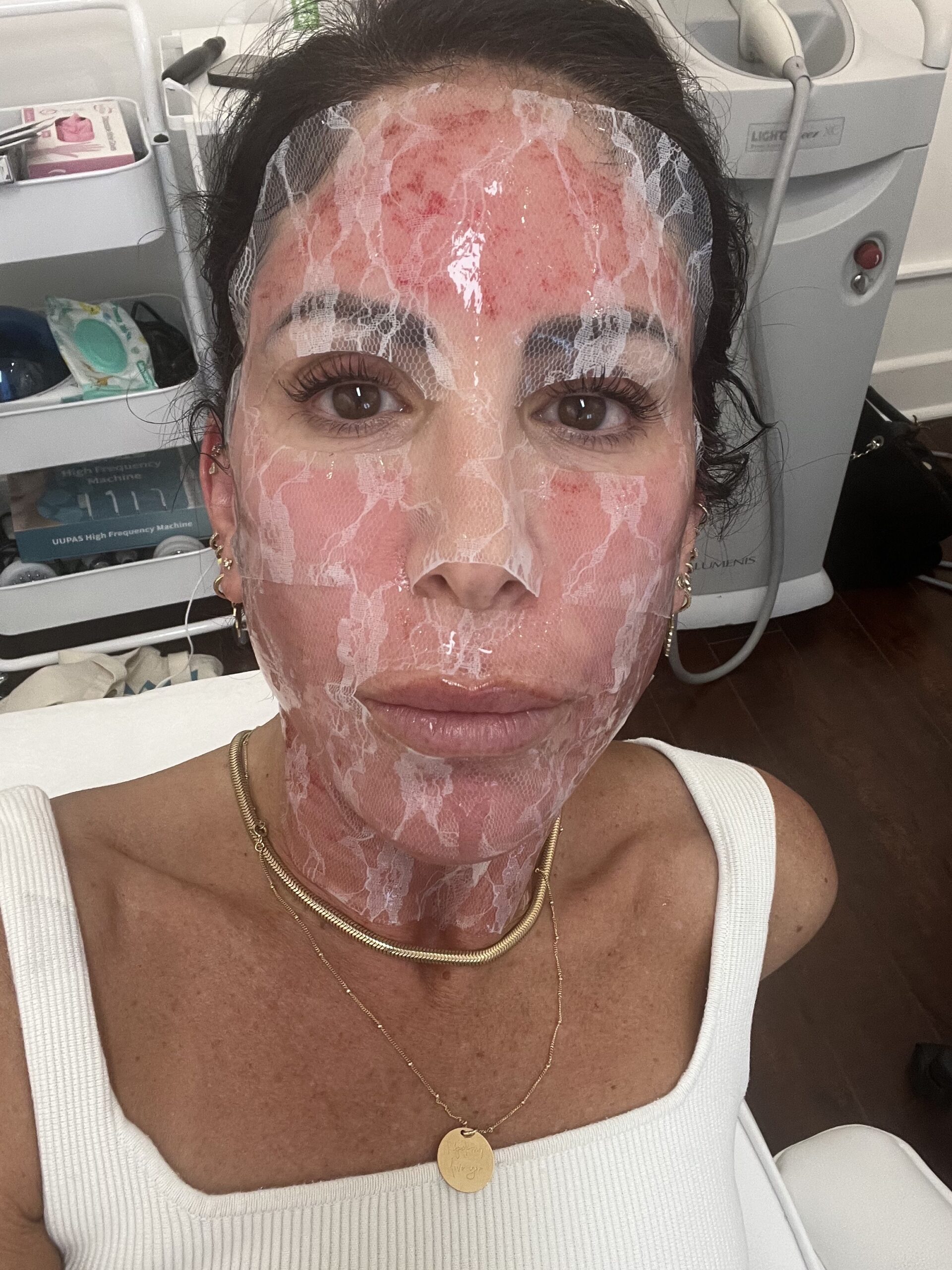 The Noninvasive Treatment That Gives Me Radiant Skin